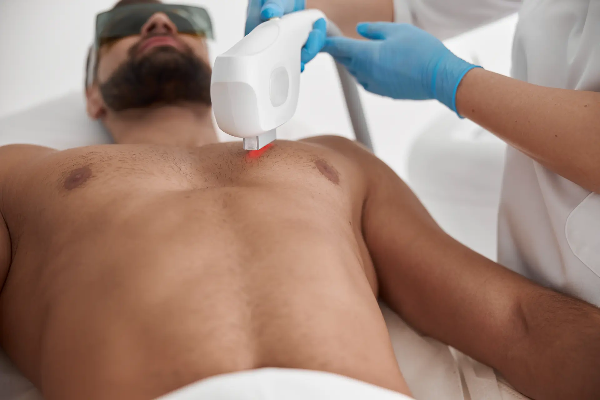 Laser Hair Removal – Men