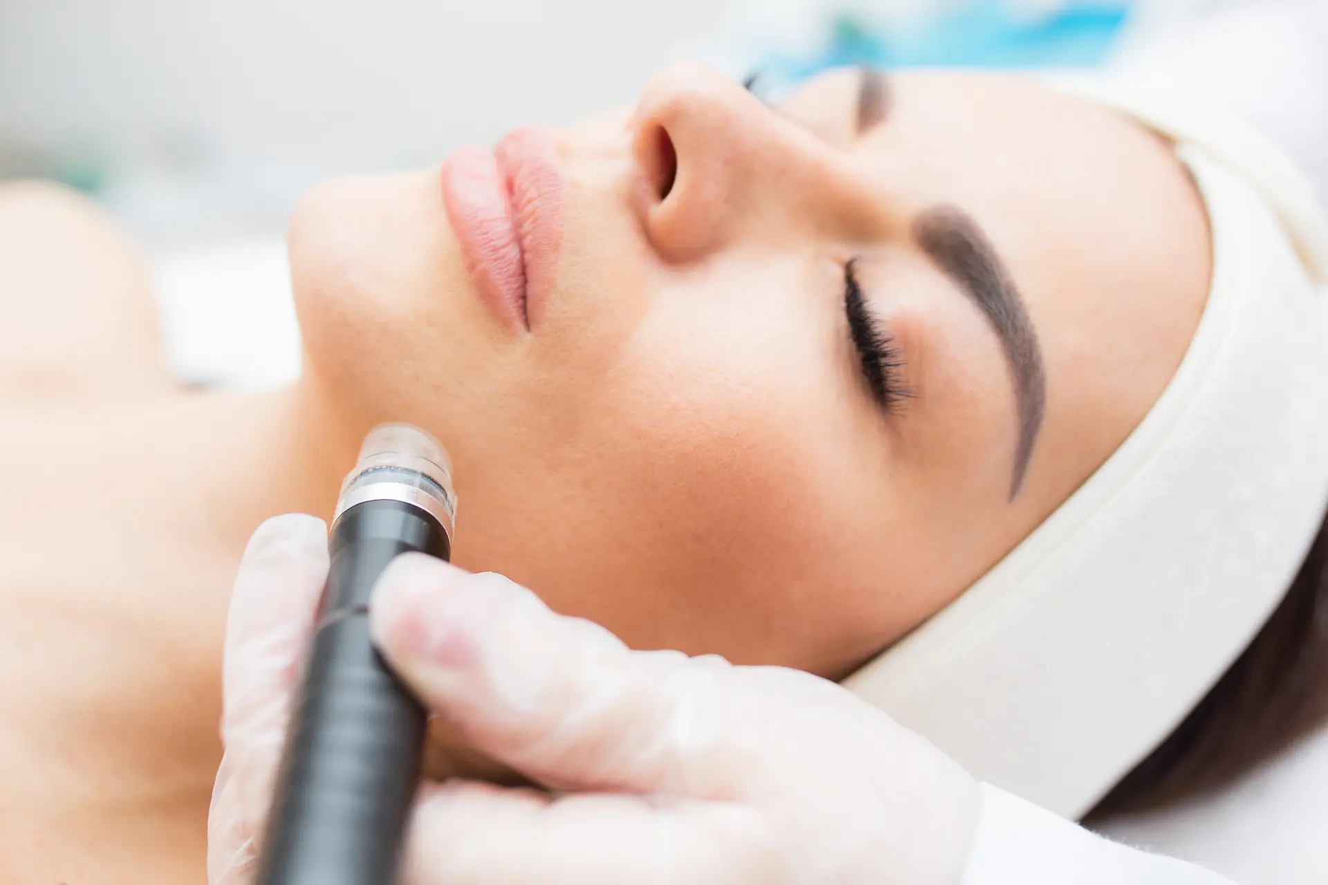 Microdermabrasion Facial